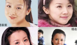 整容失败的明星有谁,盘点那些整容失败的明星