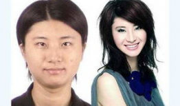 整容失败的明星有谁,盘点那些整容失败的明星