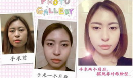 四方脸图片,探索个性化美颜新趋势